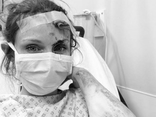 Sophie Ellis-Bextor hospitalized after an unsuccessful bike ride