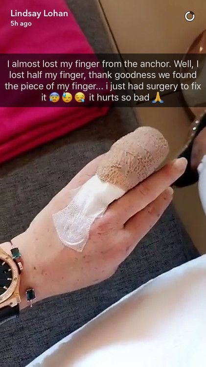 Lindsay Lohan Lost Half Her Finger